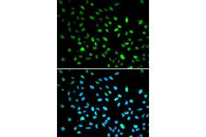 Immunofluorescence analysis of A549 cell using DDIT3 antibody. (DDIT3 antibody  (C-Term))