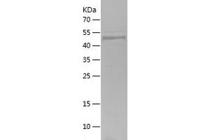 Western Blotting (WB) image for Myosin 9 (MYH9) (AA 2-241) protein (His-IF2DI Tag) (ABIN7124054) (Myosin 9 Protein (MYH9) (AA 2-241) (His-IF2DI Tag))