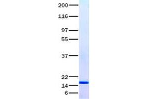 Validation with Western Blot (IL1F9 Protein)