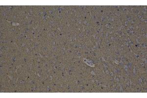 Immunohistochemistry analysis of paraffin-embedded mouse brain using GAP43 Polyclonal Antibody at dilution of 1:300. (GAP43 antibody)