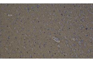 Immunohistochemistry analysis of paraffin-embedded mouse brain using GAP43 Polyclonal Antibody at dilution of 1:300.