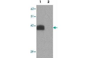Western blot analysis of SLC39A2 in rat brain tissue lysate with SLC39A2 polyclonal antibody  at 1 ug/mL in (1) the absence and (2) the presence of blocking peptide. (ZIP2 antibody  (N-Term))