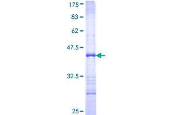 DFFB Protein (AA 229-338) (GST tag)