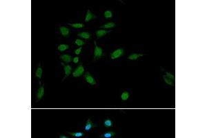 Immunofluorescence analysis of U2OS cells using PSMA1 Polyclonal Antibody at dilution of 1:100. (PSMA1 antibody)