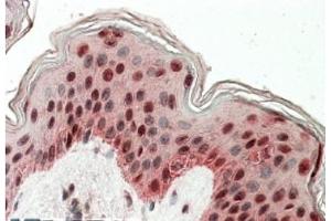 AP21273PU-N TIAL1 antibody staining of paraffin embedded Human Skin at 3. (TIAL1 antibody  (Internal Region))