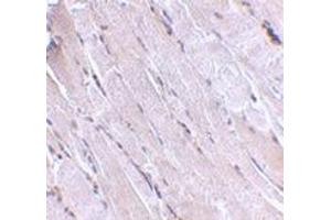 Immunohistochemistry (Paraffin-embedded Sections) (IHC (p)) image for anti-Wingless-Type MMTV Integration Site Family, Member 10B (WNT10B) (Center) antibody (ABIN501124)