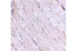 Immunohistochemistry of Wnt10b in human skeletal muscle with this product at 2. (WNT10B antibody  (Center))