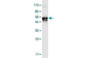 Western Blot detection against Immunogen (52. (IGFBP6 antibody  (AA 1-240))