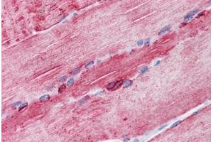 Human Skeletal muscle: Formalin-Fixed, Paraffin-Embedded (FFPE) (ATP2A1/SERCA1 antibody  (AA 522-613))