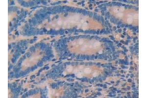 DAB staining on IHC-P; Samples: Rat Small intestine Tissue (ANGPTL2 antibody  (AA 47-207))