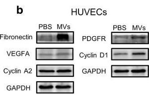 Effect of ASC-MV treatment on gene expression in all three kinds of cells. (Cyclin D1 antibody  (C-Term))