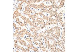 Immunohistochemistry of paraffin-embedded human liver using KIR3DS1 antibody. (KIR3DS1 antibody  (AA 80-340))