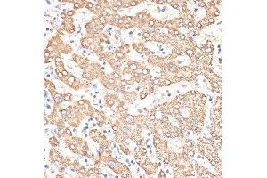 Immunohistochemistry of paraffin-embedded human liver using KIR3DS1 antibody. (KIR3DS1 antibody  (AA 80-340))