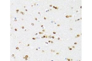 Immunohistochemistry of paraffin-embedded Mouse brain using DDX21 Polyclonal Antibody at dilution of 1:100 (40x lens).