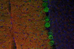 Indirect immunostaining of PFA fixed mouse cerebellum section with anti-M6a Glycoprotein (dilution 1 : 200; red) and mouse anti-calbindin (cat. (GPM6A antibody)
