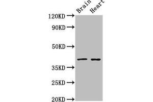 Western Blot Positive WB detected in: Rat brain tissue, Rat heart tissue All lanes: CERS1 antibody at 3 μg/mL Secondary Goat polyclonal to rabbit IgG at 1/50000 dilution Predicted band size: 40, 38 kDa Observed band size: 40 kDa (LASS1 antibody  (AA 1-52))