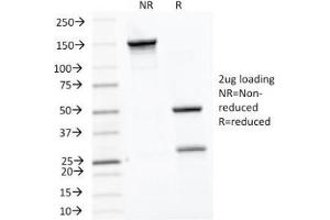 SDS-PAGE Analysis of Purified, BSA-Free HSP60 Antibody (clone LK1).