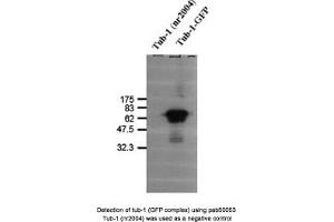Image no. 1 for anti-Tubby Homolog (TUB) antibody (ABIN363362) (TUB antibody)