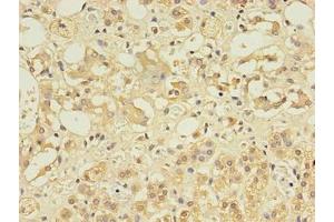 Immunohistochemistry of paraffin-embedded human adrenal gland tissue using ABIN7148084 at dilution of 1:100 (CCDC134 antibody  (AA 23-229))