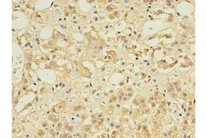 Immunohistochemistry of paraffin-embedded human adrenal gland tissue using ABIN7148084 at dilution of 1:100 (CCDC134 antibody  (AA 23-229))