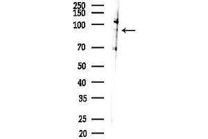 Western blot analysis of lysates from COLO205 cells(heat-shock,45 min treatment), using Phospho-SB (Ser731) Antibody at 1/1000 dilution.