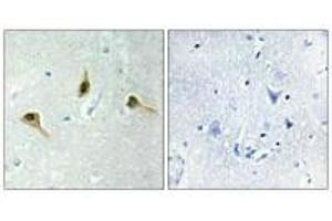 Immunohistochemistry analysis of paraffin-embedded human brain tissue using MSH2 antibody. (MSH2 antibody)