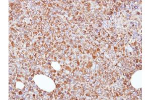 IHC-P Image Immunohistochemical analysis of paraffin-embedded H1299 xenograft, using ERp57, antibody at 1:500 dilution. (PDIA3 antibody  (C-Term))