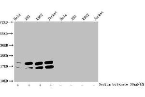 Western Blot Detected samples: Hela whole cell lysate, 293 whole cell lysate, K562 whole cell lysate, Jurkat whole cell lysate, Untreated (-) or treated (+) with 30 mM sodium butyrate for 4h All lanes: HIST1H1C antibody at 1:2000 Secondary Goat polyclonal to rabbit IgG at 1/40000 dilution Predicted band size: 22 kDa Observed band size: 22 kDa (HIST1H1C antibody  (acLys96))