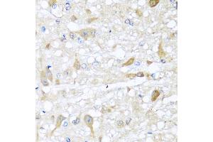 Immunohistochemistry of paraffin-embedded rat brain using CBR4 antibody (ABIN5972931) at dilution of 1/100 (40x lens). (CBR4 antibody)