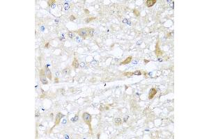 Immunohistochemistry of paraffin-embedded rat brain using CBR4 antibody (ABIN5972931) at dilution of 1/100 (40x lens). (CBR4 antibody)