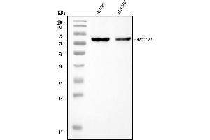 Western blot analysis of TEM8/ATR/ANTXR1 using anti-TEM8/ATR/ANTXR1 antibody (ABIN7601347).