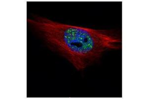 ICC/IF Image Confocal immunofluorescence analysis (Olympus FV10i) of paraformaldehyde-fixed HeLa, using PPP1A, antibody (Green) at 1:500 dilution. (PPP1CA antibody  (Center))