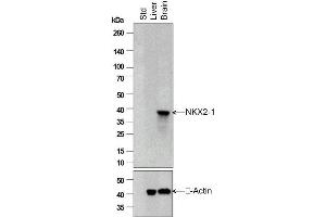 Independently Validated Antibody, image provided by Science Direct, badge number 028752. (TTF1 antibody  (AA 201-300))