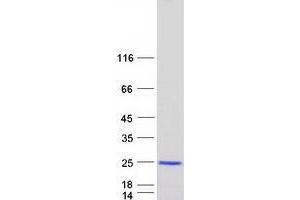 Vacuolar Protein-Sorting-Associated Protein 25 (VPS25) protein (Myc-DYKDDDDK Tag)
