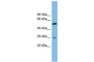 WB Suggested Anti-TM4SF20 Antibody Titration: 0. (TM4SF20 antibody  (Middle Region))