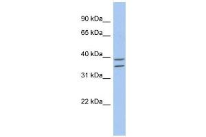 ZADH2 antibody used at 1 ug/ml to detect target protein. (ZADH2 antibody  (N-Term))