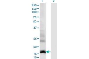 Western Blot analysis of DAAM2 expression in transfected 293T cell line by DAAM2 monoclonal antibody (M01), clone 1D8. (DAAM2 antibody  (AA 1-132))