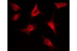 ABIN6269220 staining SW626 by IF/ICC. (CTNNB1 antibody  (N-Term))