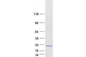 Validation with Western Blot