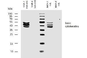 Western blotting analysis of human basic cytokeratins using mouse monoclonal antibody AE3 on lysates of MCF-7 cell line and Molt-4 cell line (cytokeratin non-expressing cell line, negative control) under non-reducing and reducing conditions. (Keratin Basic antibody)