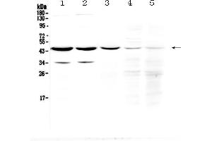 Western blot analysis of HOMER3 using anti-HOMER3 antibody . (HOMER3 antibody  (AA 282-360))