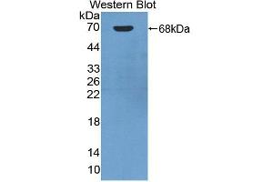 Figure. (Angiostatin antibody  (AA 100-434))