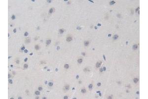 Detection of BRD8 in Mouse Brain Tissue using Polyclonal Antibody to Bromodomain Containing Protein 8 (BRD8) (BRD8 antibody  (AA 797-951))