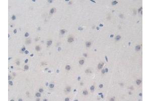 Detection of BRD8 in Mouse Brain Tissue using Polyclonal Antibody to Bromodomain Containing Protein 8 (BRD8)