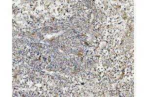 IHC analysis of NDUFB2 using anti-NDUFB2 antibody (ABIN7600162).