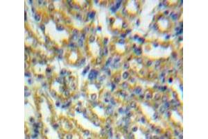Used in DAB staining on fromalin fixed paraffin-embedded Kidney tissue (HSPD1 antibody  (AA 28-573))