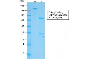 SDS-PAGE Analysis Purified VEGI Rabbit Monoclonal Antibody (VEGI /2052R). (Recombinant TNFSF15 antibody)