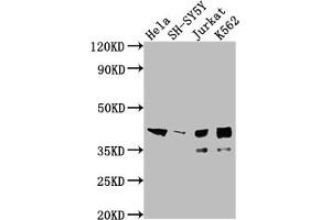 Western Blot Positive WB detected in: Hela whole cell lysate, SH-SY5Y whole cell lysate, Jurkat whole cell lysate, K562 whole cell lysate All lanes: ISL1 antibody at 1:2000 Secondary Goat polyclonal to rabbit IgG at 1/50000 dilution Predicted band size: 40 kDa Observed band size: 39 kDa (Recombinant ISL1 antibody)
