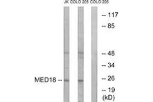 Western blot analysis of extracts from COLO/Jurkat cells, using MED18 Antibody. (MED18 antibody  (AA 70-119))