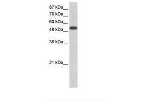 Image no. 1 for anti-Zinc Finger Protein 416 (ZNF416) (AA 90-139) antibody (ABIN202795)